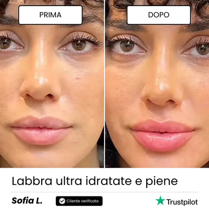 Lip Roller Labbra + Siero