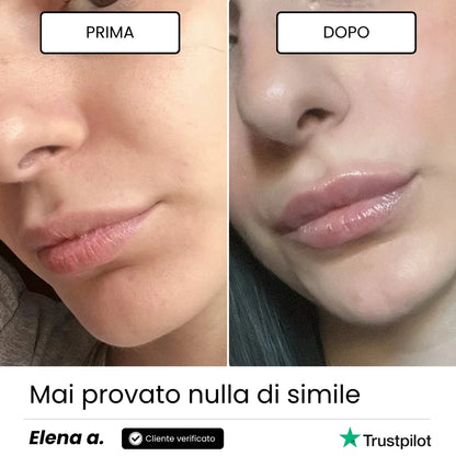 Lip Roller Labbra + Siero
