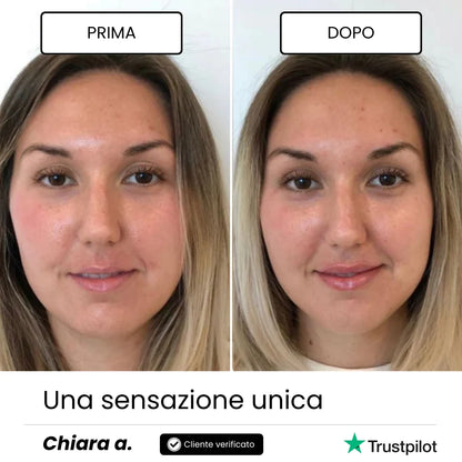Lip Roller Labbra + Siero